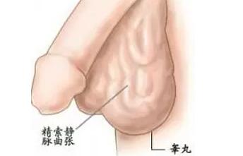 精索靜脈曲張，手術還是等待？