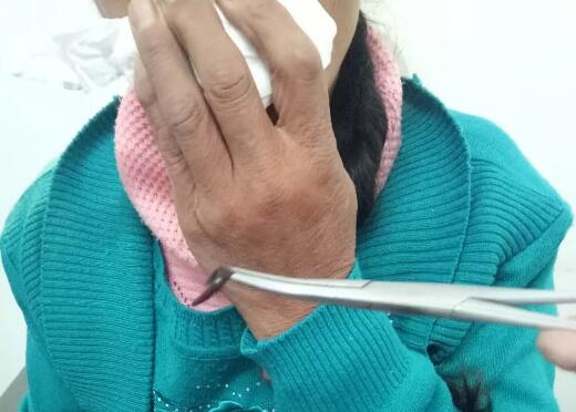 雞皮疙瘩掉一地，鼻子出螞蟥就在你身邊，你還敢喝生水嗎？