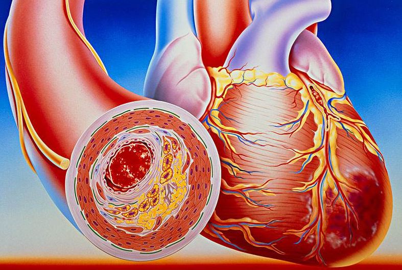 看清心臟動脈，判斷病癥，及早治療冠心??！