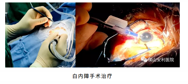 相約星期六，省級眼科、心內(nèi)科專家到院坐診、開展手術(shù)治療