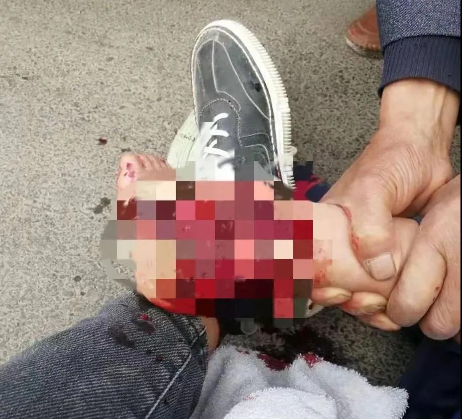 【保山安利醫(yī)院】創(chuàng)傷急救到處跑，不如安利把醫(yī)找！