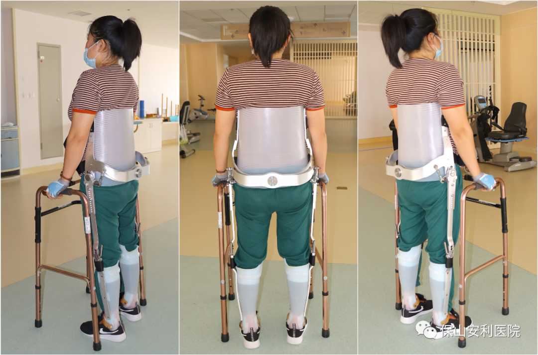 【保山安利醫(yī)院】意外墜樹導(dǎo)致截癱，量身定制截癱步行器（RGO）幫助患者逐步恢復(fù)行走能力！