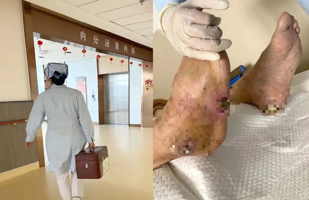 【保山安利醫(yī)院】傷口治療一站式，健康生活零距離！